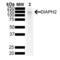 Gamma-Aminobutyric Acid Type A Receptor Alpha2 Subunit antibody, SMC-486D-P594, StressMarq, Western Blot image 