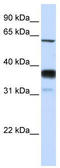 Sphingomyelin Phosphodiesterase 3 antibody, TA331049, Origene, Western Blot image 