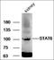 Signal Transducer And Activator Of Transcription 5A antibody, orb11432, Biorbyt, Western Blot image 