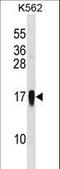 C-C Motif Chemokine Ligand 7 antibody, LS-C168459, Lifespan Biosciences, Western Blot image 