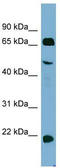 Zinc Finger Protein 746 antibody, TA330192, Origene, Western Blot image 