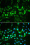 TIMP Metallopeptidase Inhibitor 2 antibody, 16-119, ProSci, Immunofluorescence image 