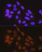Methyltransferase Like 3 antibody, GTX33315, GeneTex, Immunofluorescence image 