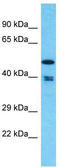 THUMP Domain Containing 1 antibody, TA331886, Origene, Western Blot image 