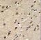 DEAD-Box Helicase 5 antibody, LS-C100666, Lifespan Biosciences, Immunohistochemistry frozen image 