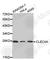 C-Type Lectin Domain Family 4 Member A antibody, A2713, ABclonal Technology, Western Blot image 