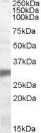 Egl-9 Family Hypoxia Inducible Factor 3 antibody, PA5-18957, Invitrogen Antibodies, Western Blot image 
