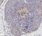 Fms Related Tyrosine Kinase 1 antibody, NB100-527, Novus Biologicals, Immunohistochemistry paraffin image 