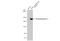 Thrombospondin 2 antibody, GTX635393, GeneTex, Western Blot image 