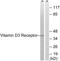 Vitamin D Receptor antibody, LS-C118330, Lifespan Biosciences, Western Blot image 