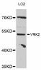 VRK Serine/Threonine Kinase 2 antibody, abx126788, Abbexa, Western Blot image 