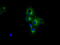 Protein Kinase CAMP-Dependent Type II Regulatory Subunit Alpha antibody, M03911-2, Boster Biological Technology, Immunofluorescence image 
