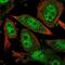 Coactivator Associated Arginine Methyltransferase 1 antibody, NBP2-55993, Novus Biologicals, Immunocytochemistry image 