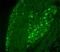 Transient Receptor Potential Cation Channel Subfamily V Member 1 antibody, GTX80788, GeneTex, Immunohistochemistry paraffin image 