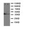 Methyl-CpG Binding Domain Protein 1 antibody, PA2041, Boster Biological Technology, Western Blot image 