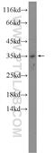 Transmembrane Protein 9 antibody, 19918-1-AP, Proteintech Group, Western Blot image 