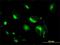 Syntaxin 6 antibody, H00010228-M01, Novus Biologicals, Immunofluorescence image 
