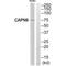 Calpain 9 antibody, A11197, Boster Biological Technology, Western Blot image 