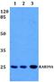 RAB39A, Member RAS Oncogene Family antibody, A11551, Boster Biological Technology, Western Blot image 