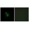 Par-3 Family Cell Polarity Regulator antibody, A01897, Boster Biological Technology, Immunohistochemistry paraffin image 