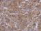 Radixin antibody, GTX105408, GeneTex, Immunohistochemistry paraffin image 