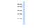 Transmembrane Protein With EGF Like And Two Follistatin Like Domains 1 antibody, PA5-69376, Invitrogen Antibodies, Western Blot image 