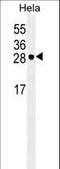 Eukaryotic Translation Initiation Factor 4E antibody, LS-B12932, Lifespan Biosciences, Western Blot image 