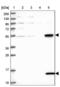 UFM1 Specific Peptidase 2 antibody, NBP1-86781, Novus Biologicals, Western Blot image 