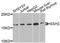 Slingshot Protein Phosphatase 2 antibody, orb374331, Biorbyt, Western Blot image 