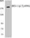 Insulin Receptor Substrate 1 antibody, EKC2590, Boster Biological Technology, Western Blot image 