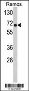 POTE Ankyrin Domain Family Member D antibody, 57-707, ProSci, Western Blot image 