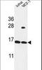 Small Proline Rich Protein 1A antibody, LS-C161473, Lifespan Biosciences, Western Blot image 