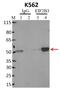 Eukaryotic Translation Initiation Factor 2B Subunit Gamma antibody, MA1-078, Invitrogen Antibodies, Immunoprecipitation image 