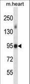 Mitogen-Activated Protein Kinase Kinase Kinase 21 antibody, LS-C164487, Lifespan Biosciences, Western Blot image 