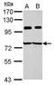 Insulin Like Growth Factor 2 MRNA Binding Protein 3 antibody, GTX115459, GeneTex, Western Blot image 