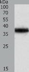 Tropomyosin 2 antibody, TA322874, Origene, Western Blot image 