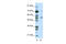 TACO antibody, 28-967, ProSci, Western Blot image 