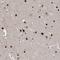 TSPY Like 1 antibody, PA5-56892, Invitrogen Antibodies, Immunohistochemistry frozen image 