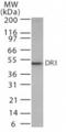 TNF Receptor Superfamily Member 25 antibody, NB100-56380, Novus Biologicals, Western Blot image 