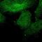 SHOC2 Leucine Rich Repeat Scaffold Protein antibody, PA5-52659, Invitrogen Antibodies, Immunofluorescence image 