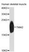 Troponin I, fast skeletal muscle antibody, STJ25908, St John