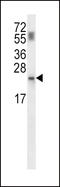 Phosphopantothenoylcysteine Decarboxylase antibody, LS-C163895, Lifespan Biosciences, Western Blot image 