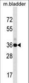 GIPC PDZ Domain Containing Family Member 1 antibody, LS-C166479, Lifespan Biosciences, Western Blot image 