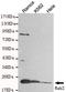 RAB2A, Member RAS Oncogene Family antibody, LS-B15500, Lifespan Biosciences, Western Blot image 