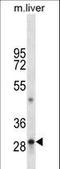 Tryptase Alpha/Beta 1 antibody, LS-C160148, Lifespan Biosciences, Western Blot image 