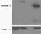 Tankyrase 2 antibody, MBS421677, MyBioSource, Western Blot image 
