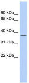 Sirtuin 6 antibody, TA330290, Origene, Western Blot image 