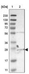 Chromosome 6 Open Reading Frame 89 antibody, NBP1-93921, Novus Biologicals, Western Blot image 
