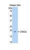 Sirtuin 5 antibody, LS-C300757, Lifespan Biosciences, Western Blot image 