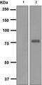 ETS Transcription Factor ERG antibody, ab133264, Abcam, Western Blot image 